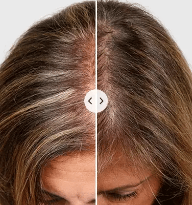 HairVitalize™ Electric Growth Booster