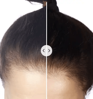 HairVitalize™ Electric Growth Booster